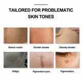 Guapa 10ml Permanent Makeup Ink Stretch Mark Camouflage Pigments Skin Tone Scar Camouflage Tattoo Ink for Restore Skin Tone