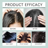 Scalp Scrub Exfoliator With Massage Brush Peppermint Rosemary & Sea Salt For Oil Control Dandruff Deep Cleansing Refreshing Set