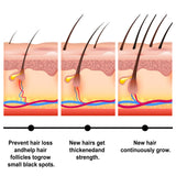 Fast Hair Growth Set Batana Oil Traction Alopecia Hair Mask Anti Break Loss Hair Growth Oil Baldness Treatment Hair Health Care