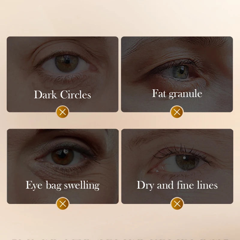 SADOER Snake Venom Peptide Caffeine Anti Wrinkle Massage Eye Cream Anti Dark Circles Anti-Aging Moisturizing Eyes Skin Care