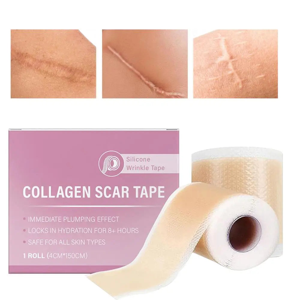 1 Roll Silicone Scar Sheets , 4cmX150cm Self-Adhesive Scar Cover Tape Reusable and Effective Skin Care Strips collagen scar tape