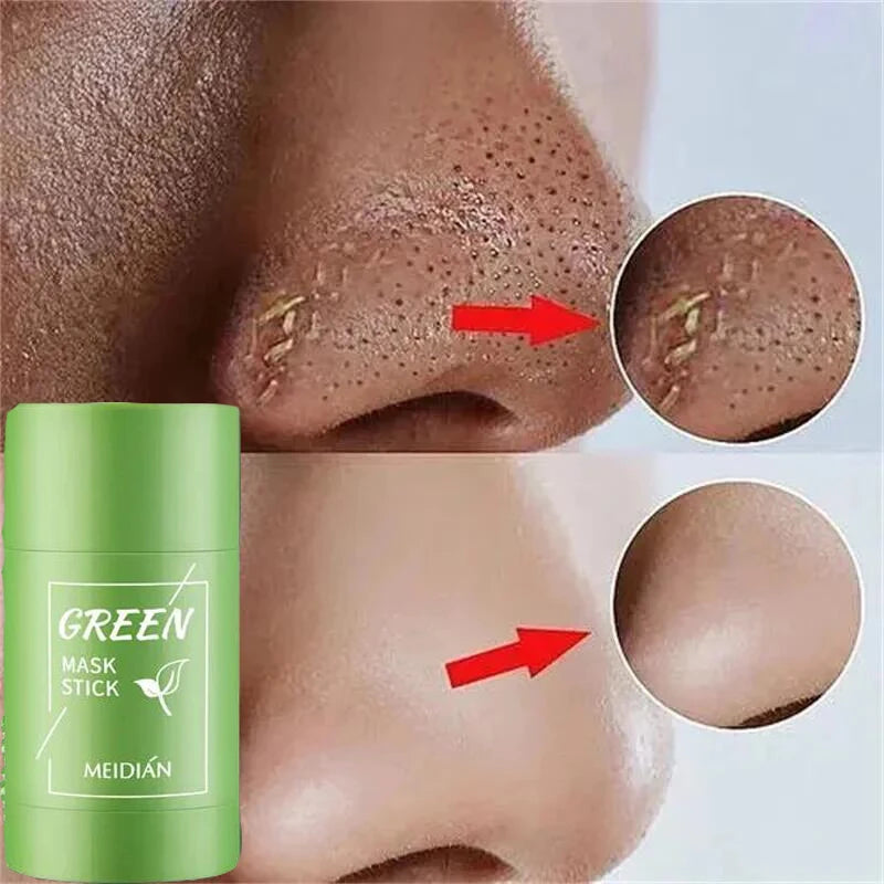 Original Facial Remove Blackhead Green Tea Solid Mask Treat Acne Blemish Black Dots Clean Stick Cream Shrink Pores Skin Care  ﻿