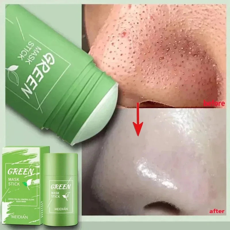 Original Facial Remove Blackhead Green Tea Solid Mask Treat Acne Blemish Black Dots Clean Stick Cream Shrink Pores Skin Care  ﻿