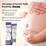 Stretch Mark Vanishing Cream Remove Body Buttock Breast Marks Effective Repair Maternity Loose Firming Skin Care