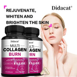 Multiple Collagen Complex - Types I, II, III, V, and X - Hair, Skin, Nail, Bones, Joint Health Support, Helps Boost Metabolism