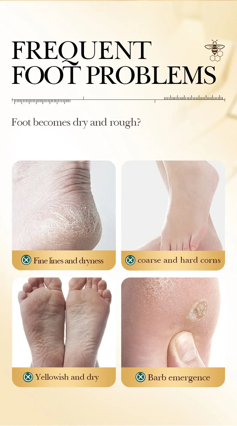 Vitamin E Honey Foot Mask Deeply Nourishes the Feet, Softens Cuticles, Making the Feet Soft, Smooth, Delicate, White, and Shiny.