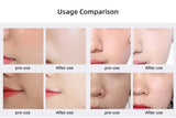 2025 New Design - Portable CO2 Oxygen Bubble Pen Rechargeable Exfoliate Device Handheld Facial Clean Machine SPA Beauty Capsules