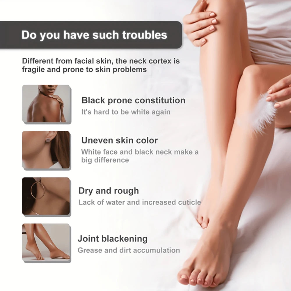Body Whitening Bleach Cream Brighten Underarm Elbow Knees Joint Removal Intimate Parts Dark Spots Melanin Snow Bleach Cream 45ml