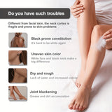 Body Whitening Bleach Cream Brighten Underarm Elbow Knees Joint Removal Intimate Parts Dark Spots Melanin Snow Bleach Cream 45ml