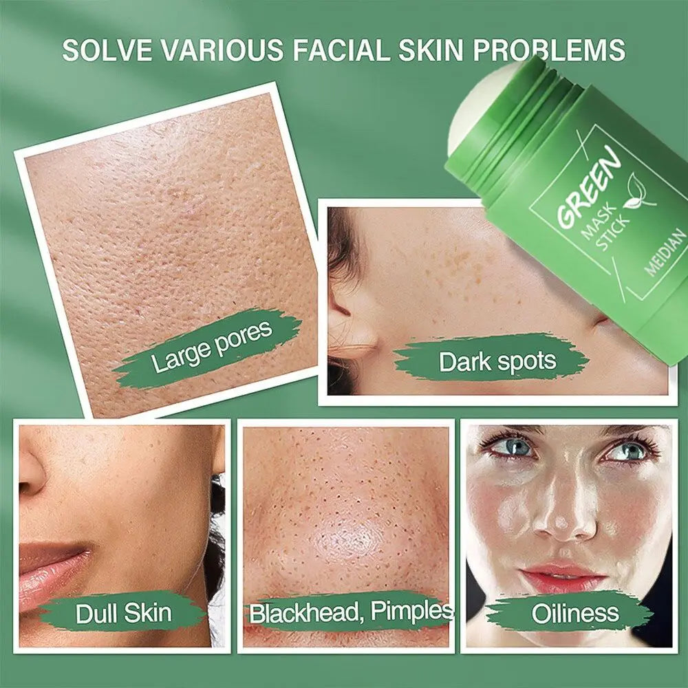 Original Facial Remove Blackhead Green Tea Solid Mask Treat Acne Blemish Black Dots Clean Stick Cream Shrink Pores Skin Care  ﻿