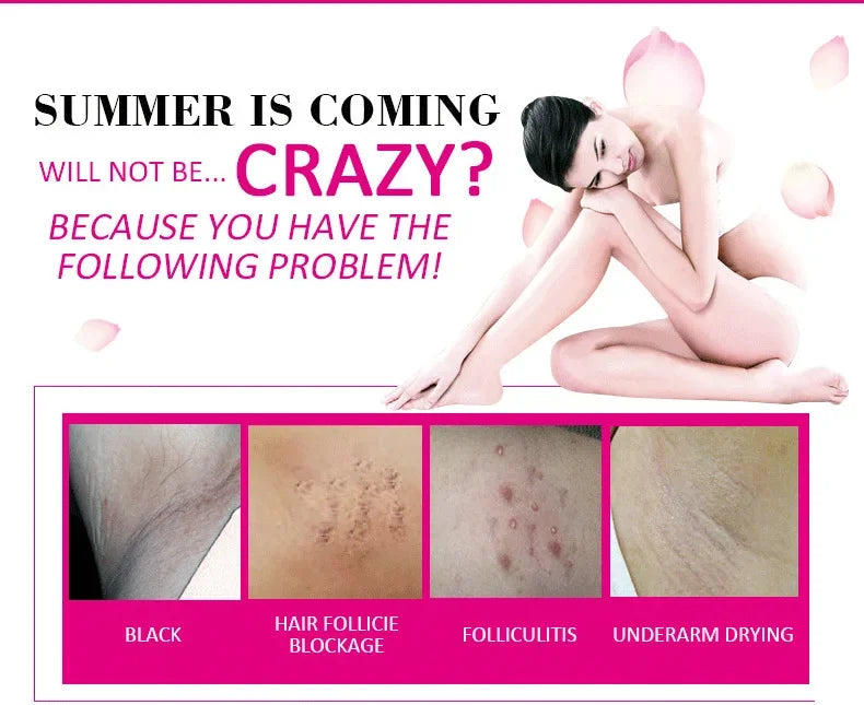 Body Whitening Bleach Cream Brighten Underarm Elbow Knees Joint Removal Intimate Parts Dark Spots Melanin Snow Bleach Cream