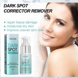 Freckle Whitening Cream Nicotinamide Fade Dark Spot Blemish Acne Mark Brightening Lightening Pigmentation Correction Cream