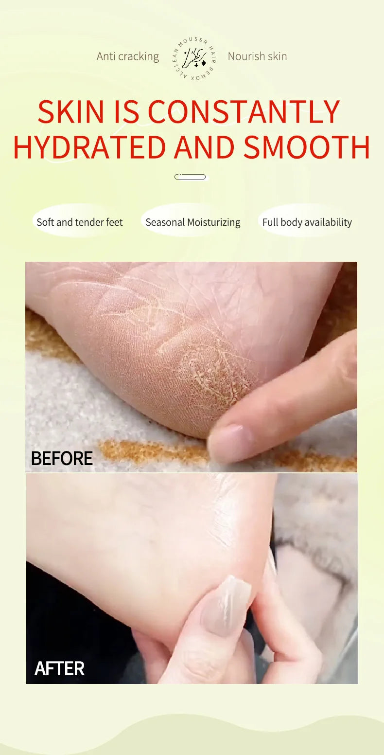 Herbal Anti Crack Foot Cream Heel Cracking Repair Products Exfoliation Dead Skin Removal Softening Moisturize Smooth Skin Care
