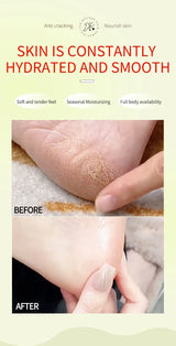 Herbal Anti Crack Foot Cream Heel Cracking Repair Products Exfoliation Dead Skin Removal Softening Moisturize Smooth Skin Care
