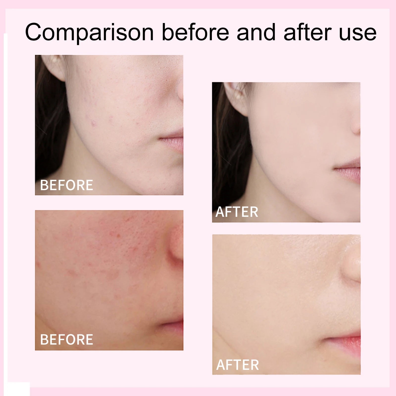Barrier Support CC Cream SPF 50 Broad Spectrum Skin Brightening Makeup Primer Redness Control Base Long-lasting Face Makeup