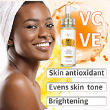 AILKE Lightening Body Cream, With Vitamin C, Hyaluronic Acid, Shea Butter, Reduce Black Spots, Even Skin Tone, Hydration Lotion
