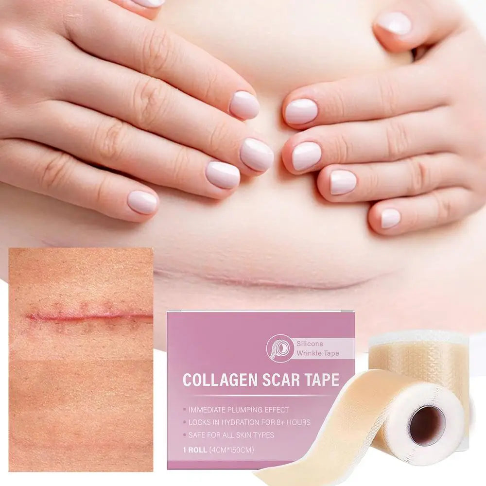 1 Roll Silicone Scar Sheets , 4cmX150cm Self-Adhesive Scar Cover Tape Reusable and Effective Skin Care Strips collagen scar tape