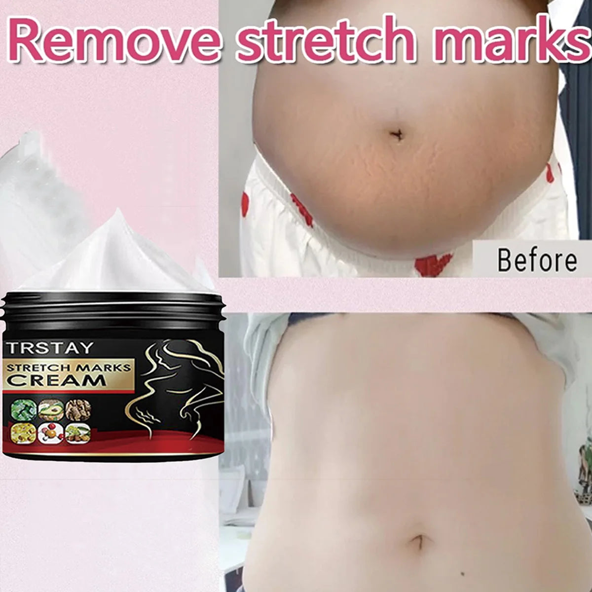 TRSTAY Stretch Mark Cream for Pregnancy Skin Replenish And Repair Cell Growth Promotion Maternity Striae Gravidarum Care