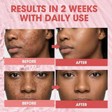 PDRN Serum Face Serum Skincare for Hydration Collagen Boost Barrier Repair Brightening Daily Skincare Uneven Tone