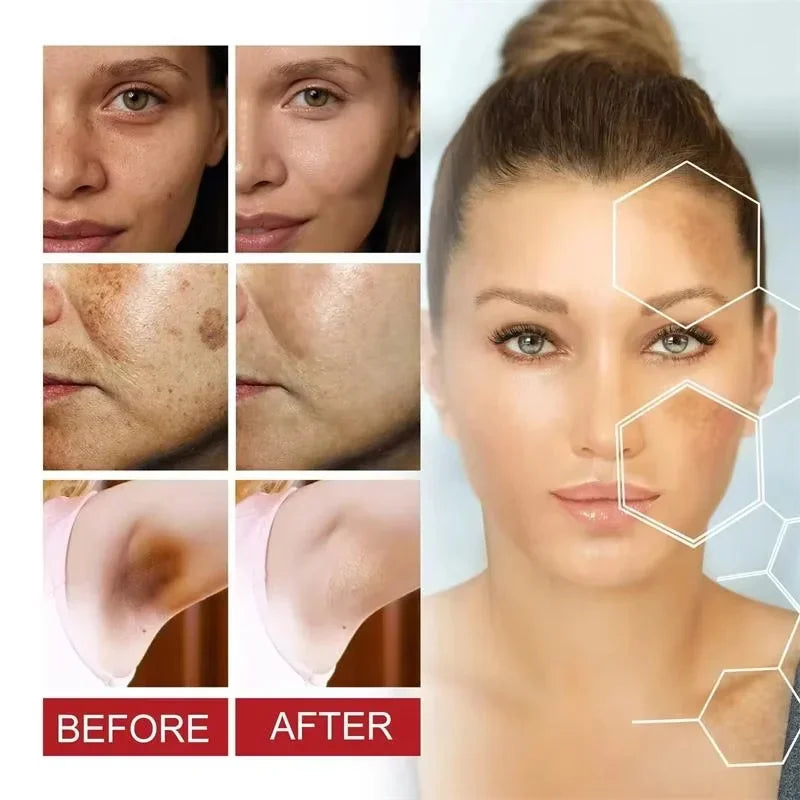 Powerful Dark Spots Remover Whitening Serum Face Freckle Melanin Correcting Anti Pigmentation Brighten Skin Beauty Care Essence