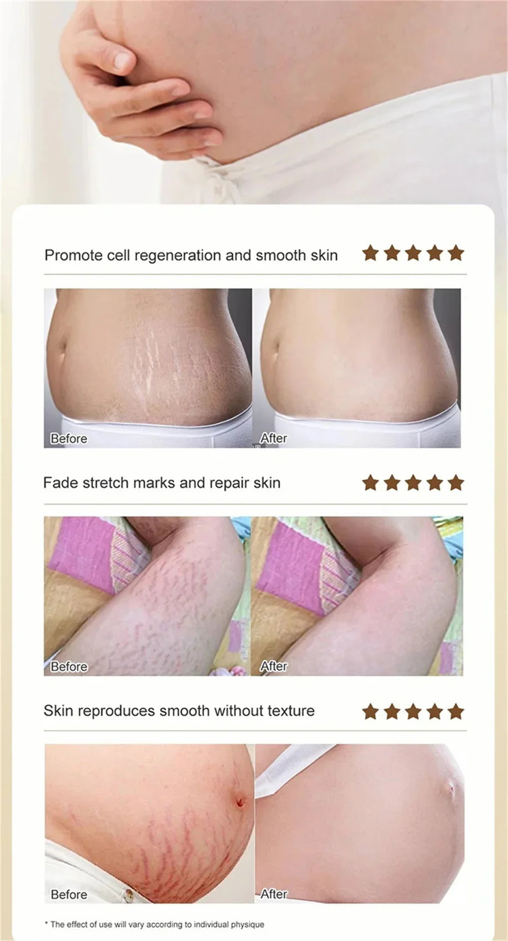 Stretch Marks Remover Essential Oil Pregnancy Maternity Body New Old Stretch Mark Removal Serum Increase Elasticity of Skin