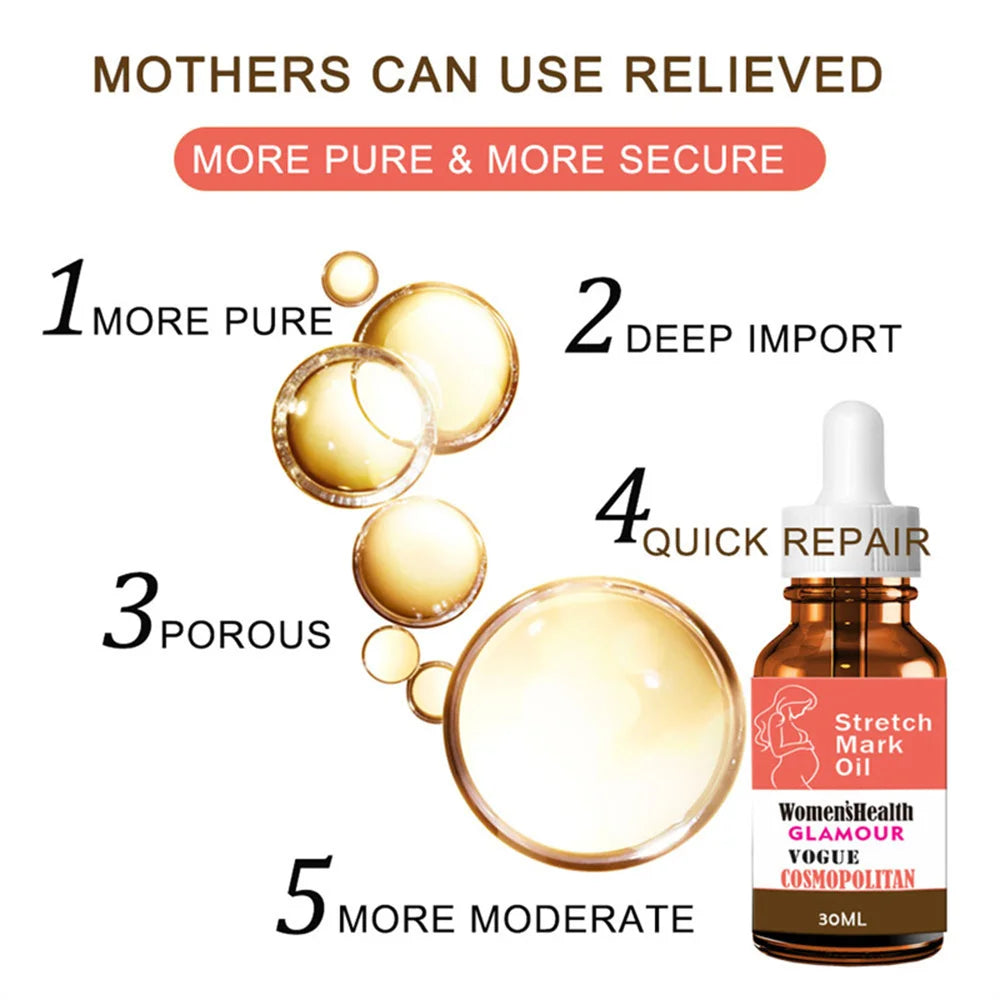 Stretch Marks Remover Essential Oil Pregnancy Maternity Body New Old Stretch Mark Removal Serum Increase Elasticity of Skin
