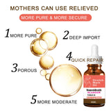 Stretch Marks Remover Essential Oil Pregnancy Maternity Body New Old Stretch Mark Removal Serum Increase Elasticity of Skin