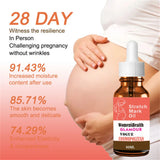 Stretch Marks Remover Essential Oil Pregnancy Maternity Body New Old Stretch Mark Removal Serum Increase Elasticity of Skin