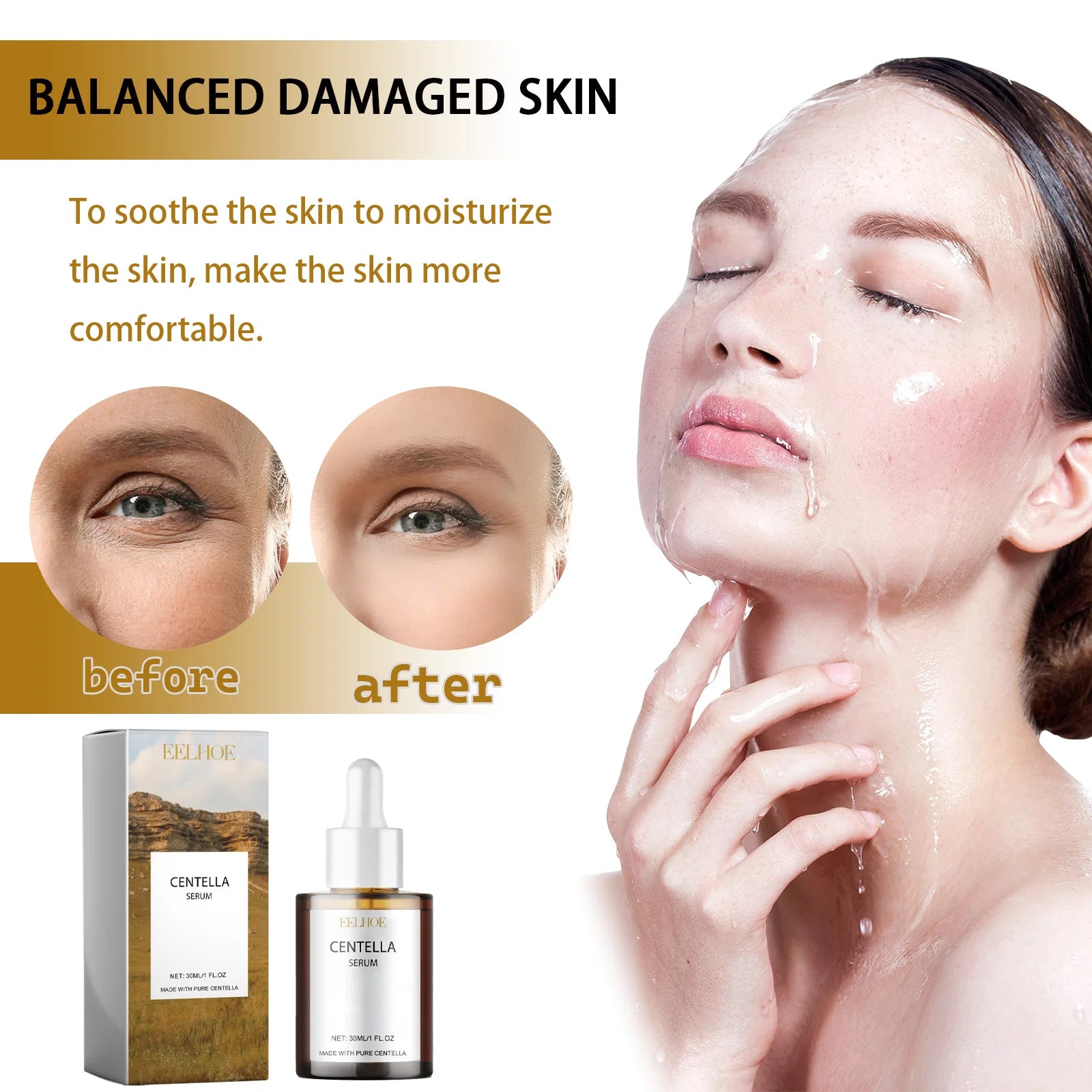 Korea Centella Asiatica Serum Sensitive Skin Soothing Formula With Acne Fighting Deep Moisturizing Benefits Gotu Kola Ampoule
