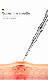 New Acne Needle Kit, Remove Blackheads, Pimples & Closed Comedones