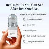 0.2MM Microneedle 2 Tools + 6 Bottles Korean Moisturizing Renewal Set, Firming & Anti-Fine Lines Daily Skin Care Essence