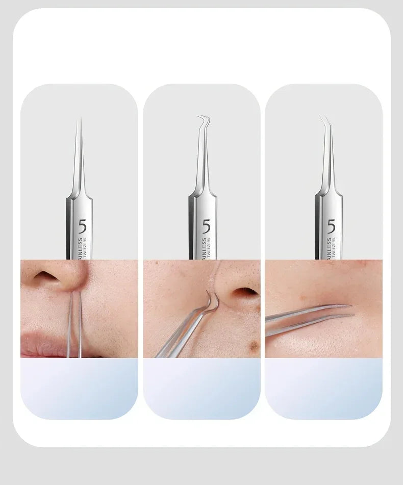 Optional 4Pcs 7Pcs 8Pcs Stainless Steel Skin Care Tool Set For Blackhead And Pimple Household Salon Grooming Accessory