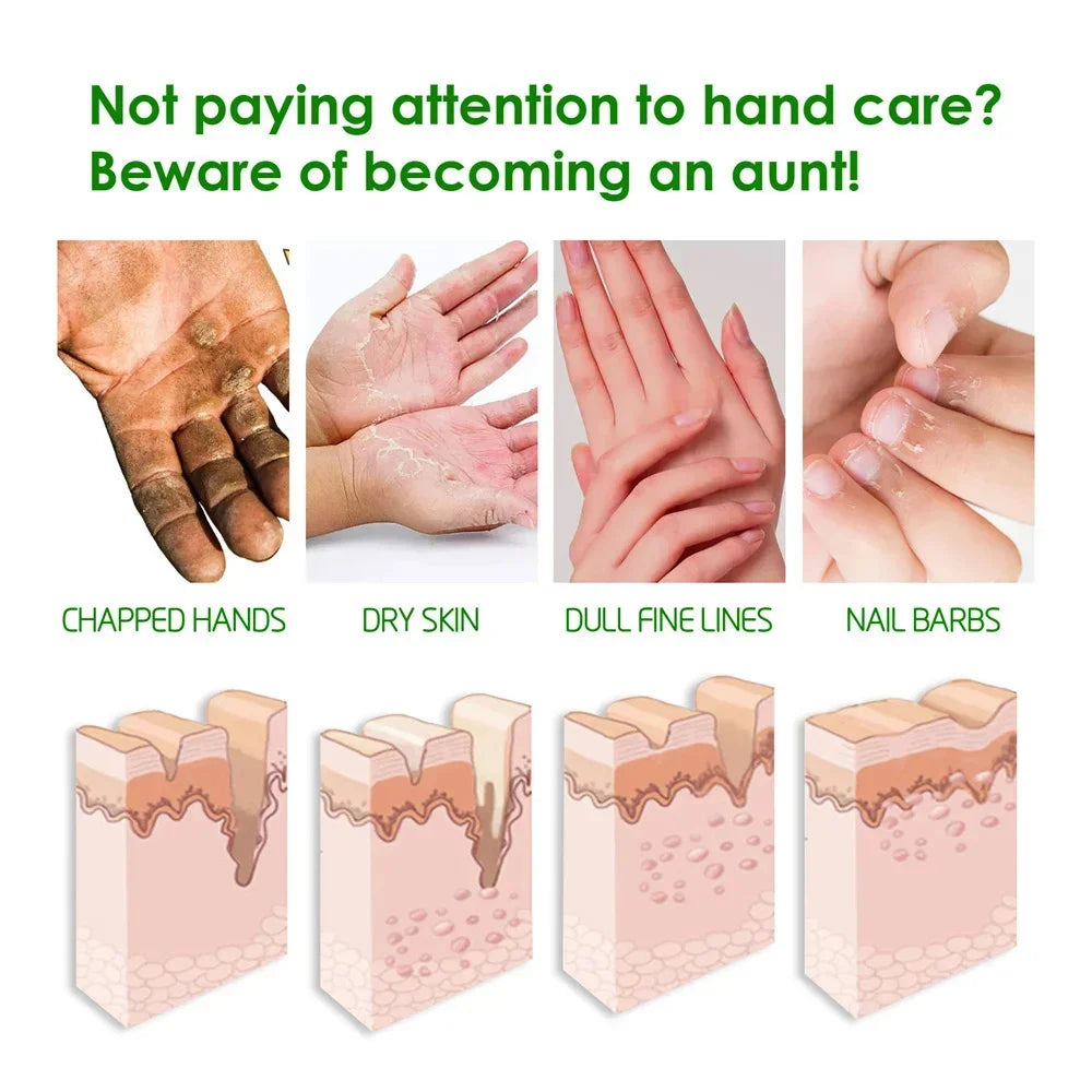 Herbal Anti Crack Foot Cream Heel Cracking Repair Products Exfoliation Dead Skin Removal Softening Moisturize Smooth Skin Care