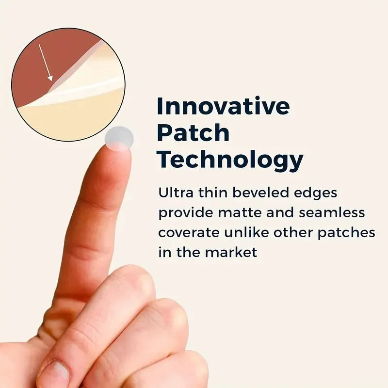 200/400/800pcs Invisible Clear Pimple Patch Set – Deep-Cleansing Hydrocolloid Acne Stickers, Mixed Sizes, Gentle & Skin-Friendly