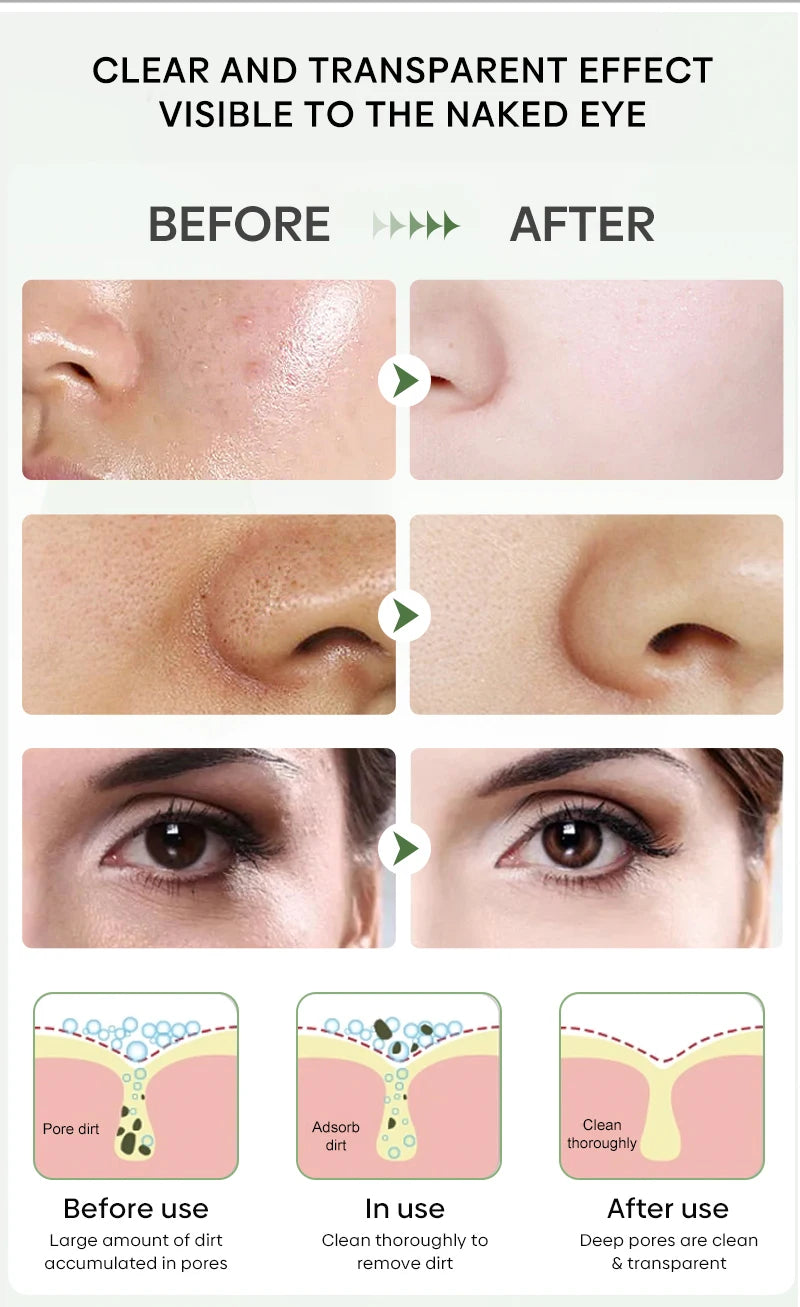Original Facial Remove Blackhead Green Tea Solid Mask Treat Acne Blemish Black Dots Clean Stick Cream Shrink Pores Skin Care  ﻿
