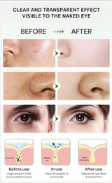 Original Facial Remove Blackhead Green Tea Solid Mask Treat Acne Blemish Black Dots Clean Stick Cream Shrink Pores Skin Care  ﻿