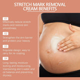 Stretch Marks Permanent Removal Cream Eliminate Body Belly Stretch Marks Swelling Marks Remove Skin Cracks Repair Firming Care