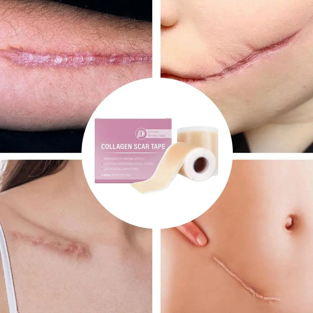 1 Roll Silicone Scar Sheets , 4cmX150cm Self-Adhesive Scar Cover Tape Reusable and Effective Skin Care Strips collagen scar tape