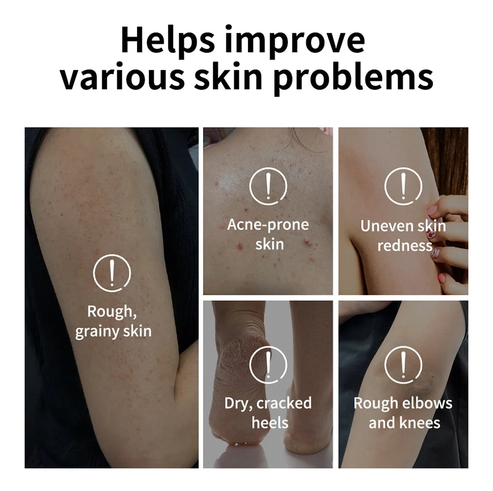 Lakerain Exfoliating Body Stick Multiple Glycolic Acid Cleaning Long-lasting Moisturizing Nourishing Smoothing Skin Care
