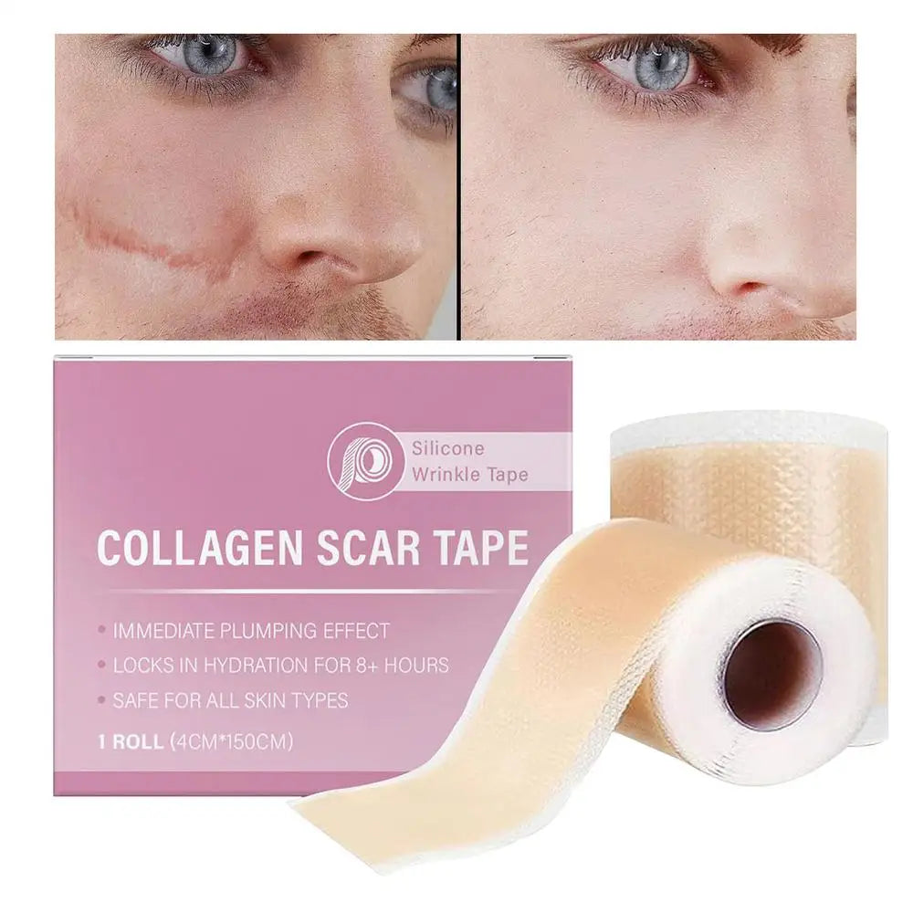 1 Roll Silicone Scar Sheets , 4cmX150cm Self-Adhesive Scar Cover Tape Reusable and Effective Skin Care Strips collagen scar tape
