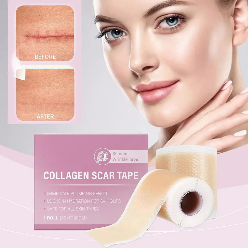 1 Roll Silicone Scar Sheets , 4cmX150cm Self-Adhesive Scar Cover Tape Reusable and Effective Skin Care Strips collagen scar tape