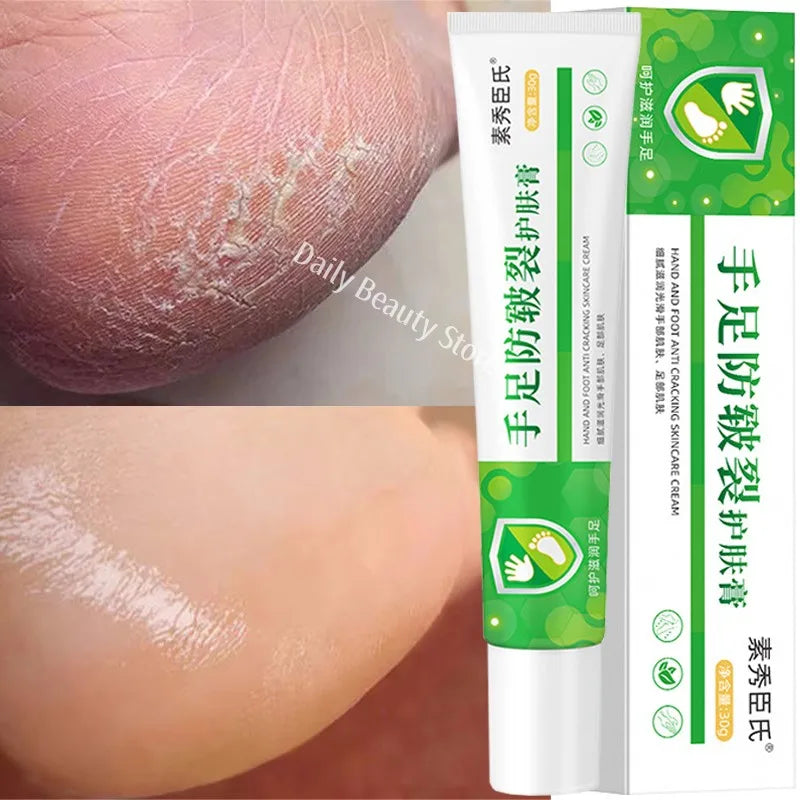 Herbal Anti Crack Foot Cream Spray Heel Cracking Repair Products Exfoliation Dead Skin Removal Softening Moisturize Smooth Care