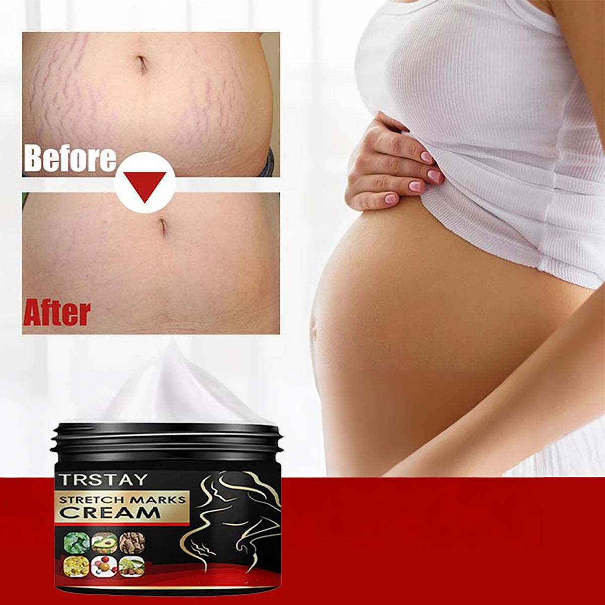 TRSTAY Stretch Mark Cream for Pregnancy Skin Replenish And Repair Cell Growth Promotion Maternity Striae Gravidarum Care